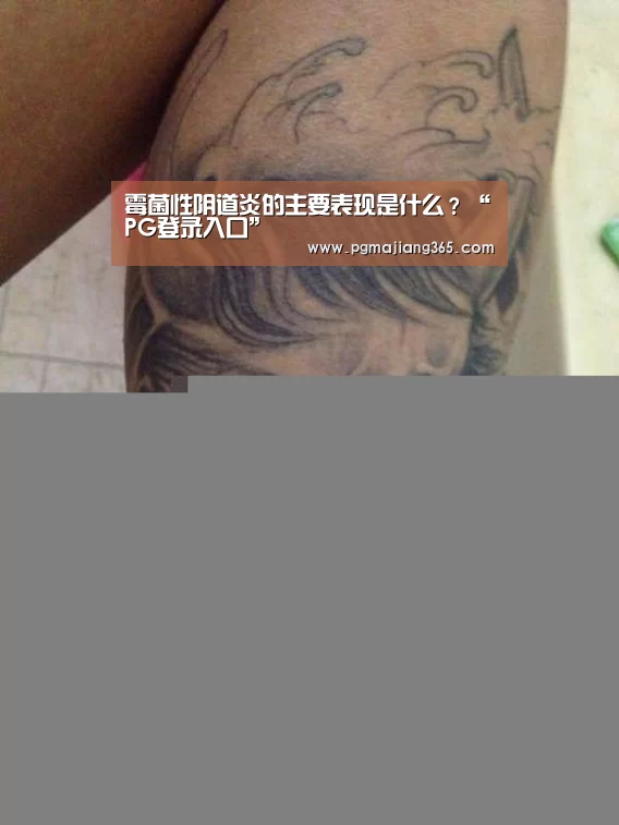 霉菌性阴道炎的主要表现是什么?“PG登录入口”(图1) PG登录入口
